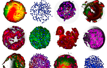 Asha Patel Cell Polymer Microarray image
