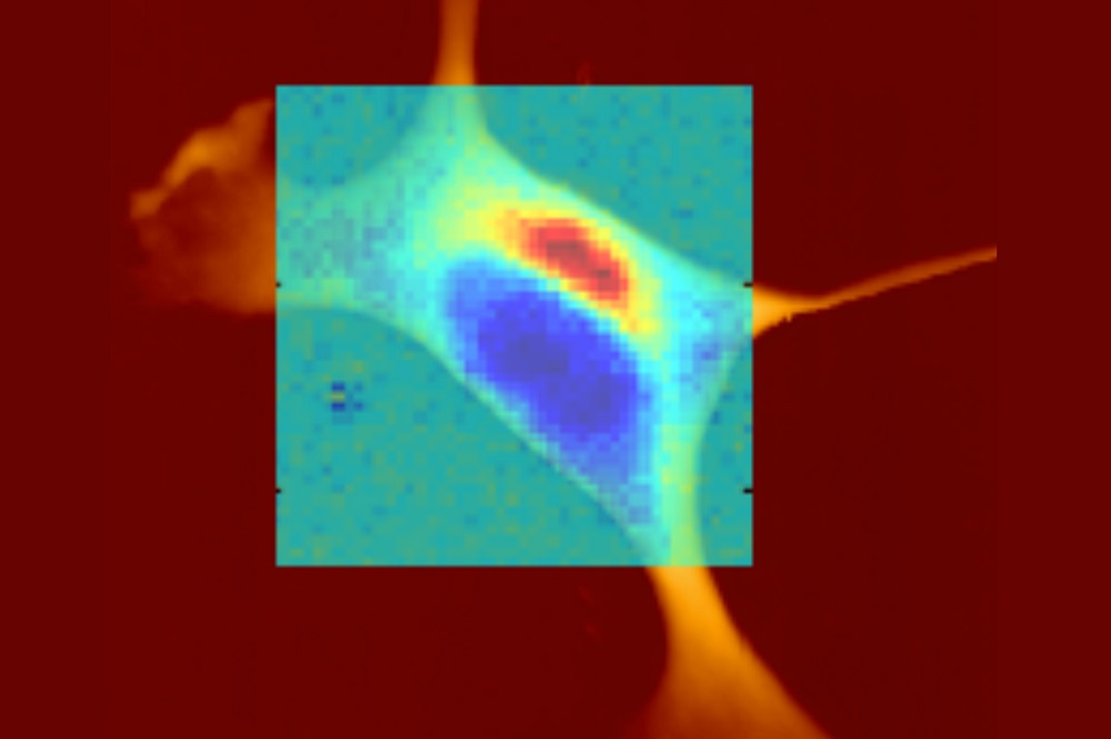 Biophotonics