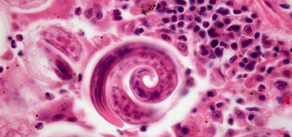 Lungworm under a microscope